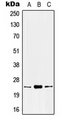 KLK8 / Kallikrein 8 Antibody - Western blot analysis of Kallikrein 8 expression in HEK293T (A); mouse kidney (B); rat kidney (C) whole cell lysates.