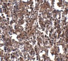 Klra2 Antibody - Immunohistochemistry of KLRA2 in mouse spleen tissue with KLRA2 antibody at 2.5 ug/ml.