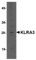 Klra3 / Ly49c Antibody - Western blot of KLRA3 in mouse brain tissue lysate with KLRA3 antibody at 2 ug/ml
