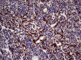 KLRB1 / CD161 Antibody - Immunohistochemical staining of paraffin-embedded Human spleen tissue within the normal limits using anti-KLRB1 mouse monoclonal antibody. (Heat-induced epitope retrieval by Tris-EDTA(1:500)