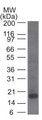 KLRB1 / CD161 Antibody - Western Blot: CD161 Antibody (14F1F11) - Western blot analysis of a partial CD161 recombinant protein using CD161 antibody at 1 ug/ml.  This image was taken for the unconjugated form of this product. Other forms have not been tested.