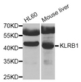 KLRB1 / CD161 Antibody - Western blot blot of extracts of various cell lines, using KLRB1 antibody.