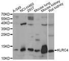 KLRC4 Antibody - Western blot analysis of extracts of various cell lines, using KLRC4 antibody at 1:1000 dilution. The secondary antibody used was an HRP Goat Anti-Rabbit IgG (H+L) at 1:10000 dilution. Lysates were loaded 25ug per lane and 3% nonfat dry milk in TBST was used for blocking. An ECL Kit was used for detection and the exposure time was 30s.