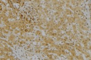 KMO Antibody - 1:100 staining mouse liver tissue by IHC-P. The sample was formaldehyde fixed and a heat mediated antigen retrieval step in citrate buffer was performed. The sample was then blocked and incubated with the antibody for 1.5 hours at 22°C. An HRP conjugated goat anti-rabbit antibody was used as the secondary.