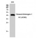 KNG1 / Kininogen / Bradykinin Antibody - Western blot of Cleaved-Kininogen-1 HC (K380) antibody