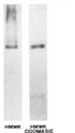 KNG1 / Kininogen / Bradykinin Antibody - Western blots to detect human HMWK light chain.