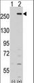 KPI-2 / LMTK2 Antibody - Western blot of LMTK2 (arrow) using rabbit polyclonal LMTK2 Antibody. 293 cell lysates (2 ug/lane) either nontransfected (Lane 1) or transiently transfected with the LMTK2 gene (Lane 2) (Origene Technologies).