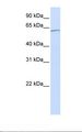 KPNA5 Antibody - Jurkat cell lysate. Antibody concentration: 1.0 ug/ml. Gel concentration: 12%.  This image was taken for the unconjugated form of this product. Other forms have not been tested.