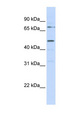 KREMEN1 / KREMEN-1 Antibody - KREMEN1 antibody Western blot of MCF7 cell lysate. This image was taken for the unconjugated form of this product. Other forms have not been tested.