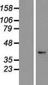 KRR1 Protein - Western validation with an anti-DDK antibody * L: Control HEK293 lysate R: Over-expression lysate