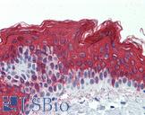 KRT1 / CK1 / Cytokeratin 1 Antibody - Anti-KRT1 / Cytokeratin 1 antibody IHC of human skin. Immunohistochemistry of formalin-fixed, paraffin-embedded tissue after heat-induced antigen retrieval. Antibody concentration 2.5 ug/ml.  This image was taken for the unconjugated form of this product. Other forms have not been tested.