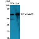 KRT10 / CK10 / Cytokeratin 10 Antibody - Western blot of Cytokeratin 10 antibody