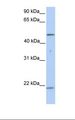 KRT10 / CK10 / Cytokeratin 10 Antibody - 721_B cell lysate. Antibody concentration: 1.0 ug/ml. Gel concentration: 12%.  This image was taken for the unconjugated form of this product. Other forms have not been tested.