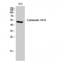 KRT14/KRT16 Antibody - Western blot of Cytokeratin 14/16 antibody