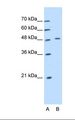 KRT20 / CK20 / Cytokeratin 20 Antibody - Lane A: Marker. Lane B: DLD1 cell lysate. Antibody concentration: 1.25 ug/ml. Gel concentration: 12%.  This image was taken for the unconjugated form of this product. Other forms have not been tested.