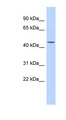 KRT24 / Keratin 24 Antibody - KRT24 / Cytokeratin 24 antibody Western blot of Fetal Kidney lysate. This image was taken for the unconjugated form of this product. Other forms have not been tested.