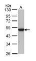 KRT31 / Keratin 31 / KRTHA1 Antibody - Sample (30 ug of whole cell lysate). A: Hela. 10% SDS PAGE. KRT31 / HHA1 antibody diluted at 1:1000.