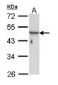 KRT33B / Keratin 33B / KRTHA3B Antibody - Sample (30 ug of whole cell lysate). A: Hela. 10% SDS PAGE. KRT33B antibody diluted at 1:1000.
