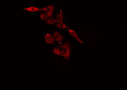 KRT37 + KRT38 Antibody - Staining LOVO cells by IF/ICC. The samples were fixed with PFA and permeabilized in 0.1% Triton X-100, then blocked in 10% serum for 45 min at 25°C. The primary antibody was diluted at 1:200 and incubated with the sample for 1 hour at 37°C. An Alexa Fluor 594 conjugated goat anti-rabbit IgG (H+L) antibody, diluted at 1/600, was used as secondary antibody.