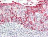 KRT6A / CK6A / Cytokeratin 6A Antibody - Human Tonsil: Formalin-Fixed, Paraffin-Embedded (FFPE).  This image was taken for the unconjugated form of this product. Other forms have not been tested.