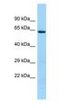 KRT74 / Keratin 74 Antibody - KRT74 antibody Western Blot of 721_B.  This image was taken for the unconjugated form of this product. Other forms have not been tested.