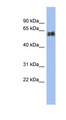 KRT75 / Keratin 75 / K6HF Antibody - KRT75 antibody Western blot of Fetal Small Intestine lysate. This image was taken for the unconjugated form of this product. Other forms have not been tested.