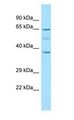 KRT77 / Keratin 77 / KRT1B Antibody - KRT77 / Keratin 1B antibody Western Blot of 721_B.  This image was taken for the unconjugated form of this product. Other forms have not been tested.