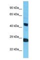 KRT80 / Keratin 80 Antibody - KRT80 antibody Western Blot of Jurkat. Antibody dilution: 1 ug/ml.  This image was taken for the unconjugated form of this product. Other forms have not been tested.
