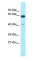 KRT9 / CK9 / Cytokeratin 9 Antibody - KRT9 / K9 antibody Western Blot of Fetal Heart.  This image was taken for the unconjugated form of this product. Other forms have not been tested.