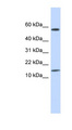 KRTAP11-1 Antibody - KRTAP11-1 antibody Western blot of Placenta lysate. This image was taken for the unconjugated form of this product. Other forms have not been tested.