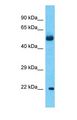 KRTAP27-1 Antibody - Western blot of KRTAP27-1 Antibody with Lung Tumor lysate.  This image was taken for the unconjugated form of this product. Other forms have not been tested.