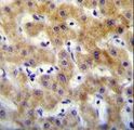KRTCAP2 Antibody - KTAP2 Antibody immunohistochemistry of formalin-fixed and paraffin-embedded human liver tissue followed by peroxidase-conjugated secondary antibody and DAB staining.