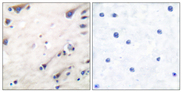 KSR1 Antibody - Immunohistochemistry analysis of paraffin-embedded human brain tissue, using KSR Antibody. The picture on the right is blocked with the synthesized peptide.