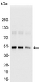 KT3 Tag Antibody - Detection of KT3-tagged fusion protein in 200, 100, and 50ng of E. coli lysate