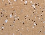 KV6.4 / KCNG4 Antibody - Immunohistochemistry of paraffin-embedded Human brain using KCNG4 Polyclonal Antibody at dilution of 1:40.