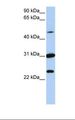 KX / XK Antibody - MCF7 cell lysate. Antibody concentration: 1.0 ug/ml. Gel concentration: 12%.  This image was taken for the unconjugated form of this product. Other forms have not been tested.