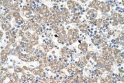 KYNU Antibody - KYNU antibody KYNU(kynureninase (L-kynurenine hydrolase)) Antibody IHC of formalin-fixed, paraffin-embedded human Liver. Positive label: Hepatocytes indicated with arrows. Antibody concentration 4-8 ug/ml. Magnification 400X.  This image was taken for the unconjugated form of this product. Other forms have not been tested.