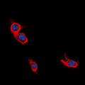 L1CAM Antibody - Immunofluorescent analysis of L1CAM staining in Jurkat cells. Formalin-fixed cells were permeabilized with 0.1% Triton X-100 in TBS for 5-10 minutes and blocked with 3% BSA-PBS for 30 minutes at room temperature. Cells were probed with the primary antibody in 3% BSA-PBS and incubated overnight at 4 deg C in a humidified chamber. Cells were washed with PBST and incubated with a DyLight 594-conjugated secondary antibody (red) in PBS at room temperature in the dark. DAPI was used to stain the cell nuclei (blue).
