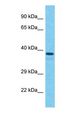 L3HYPDH / C14orf149 Antibody - Western blot of L3HYPDH Antibody with human HepG2 Whole Cell lysate.  This image was taken for the unconjugated form of this product. Other forms have not been tested.