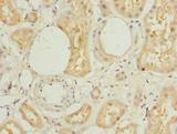 L3HYPDH / C14orf149 Antibody - Immunohistochemistry of paraffin-embedded human kidney tissue using antibody at dilution of 1:100.