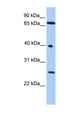 L3MBTL2 Antibody - L3MBTL2 antibody Western blot of HeLa lysate. This image was taken for the unconjugated form of this product. Other forms have not been tested.