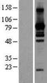 L3MBTL2 Protein - Western validation with an anti-DDK antibody * L: Control HEK293 lysate R: Over-expression lysate