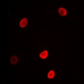 L3MBTL3 Antibody - Immunofluorescent analysis of L3MBTL3 staining in MCF7 cells. Formalin-fixed cells were permeabilized with 0.1% Triton X-100 in TBS for 5-10 minutes and blocked with 3% BSA-PBS for 30 minutes at room temperature. Cells were probed with the primary antibody in 3% BSA-PBS and incubated overnight at 4 deg C in a humidified chamber. Cells were washed with PBST and incubated with a DyLight 594-conjugated secondary antibody (red) in PBS at room temperature in the dark.