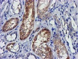 LACTB2 Antibody - IHC of paraffin-embedded Human Kidney tissue using anti-LACTB2 mouse monoclonal antibody. (Heat-induced epitope retrieval by 10mM citric buffer, pH6.0, 100C for 10min).
