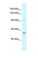 LAF4 / AFF3 Antibody - AFF3 antibody Western blot of Mouse Thymus lysate. Antibody concentration 1 ug/ml.  This image was taken for the unconjugated form of this product. Other forms have not been tested.