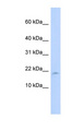 LAIR2 / CD306 Antibody - LAIR2 antibody Western blot of MCF7 cell lysate. This image was taken for the unconjugated form of this product. Other forms have not been tested.