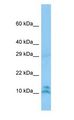 LALBA / Alpha Lactalbumin Antibody - LALBA / Alpha Lactalbumin antibody Western Blot of THP-1 cell lysate.  This image was taken for the unconjugated form of this product. Other forms have not been tested.