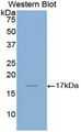 LAMA1 / Laminin Alpha 1 Antibody - Western blot of recombinant LAMA1 / Laminin Alpha 1.  This image was taken for the unconjugated form of this product. Other forms have not been tested.