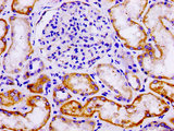 LAMA3 / Laminin Alpha 3 Antibody - Immunohistochemistry image at a dilution of 1:100 and staining in paraffin-embedded human kidney tissue performed on a Leica BondTM system. After dewaxing and hydration, antigen retrieval was mediated by high pressure in a citrate buffer (pH 6.0) . Section was blocked with 10% normal goat serum 30min at RT. Then primary antibody (1% BSA) was incubated at 4 °C overnight. The primary is detected by a biotinylated secondary antibody and visualized using an HRP conjugated SP system.