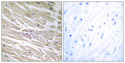 LAMA4 / Laminin Alpha 4 Antibody - Immunohistochemistry analysis of paraffin-embedded human heart tissue, using LAMA4 Antibody. The picture on the right is blocked with the synthesized peptide.